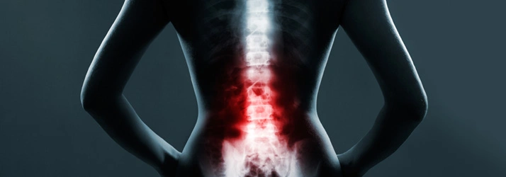 Chiropractic Lakeville MN Personal Scoliosis Hero Graphic in all grays highlighting the entire spine in bright reddish tones.